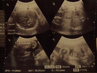 妊娠後期 ９ヶ月 の超音波写真 うれしい 楽しい 大スキ 番外編